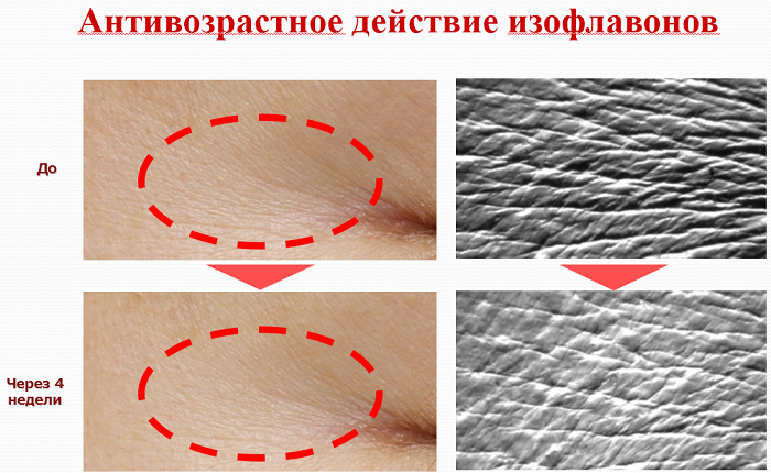 Антивозрастное действие изофлавонов